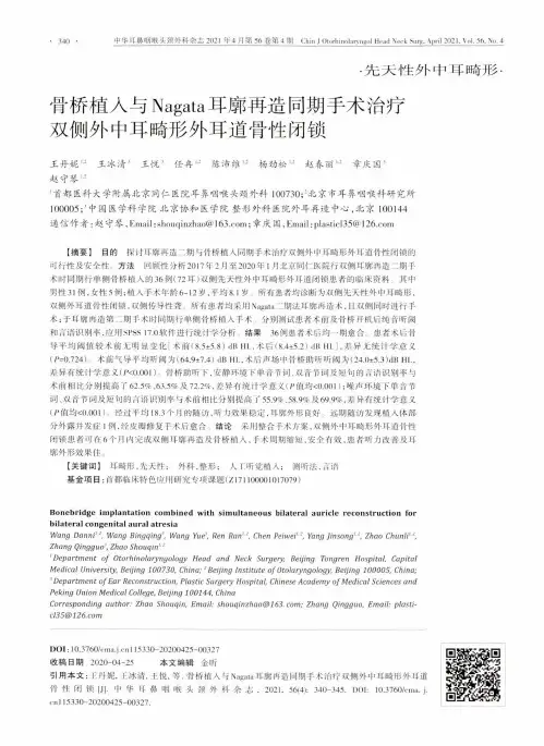 骨桥植入与Nagata耳廓再造同期手术治疗双侧外中耳畸形外耳道骨性闭锁