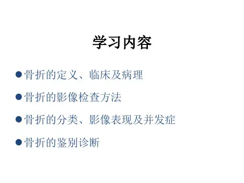 骨折的影像诊断ppt课件.pptx
