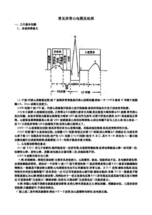 常见异常心电图及处理