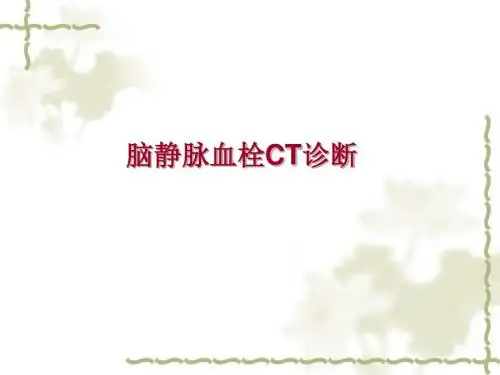 脑静脉系统血栓形成