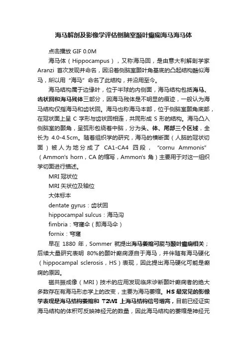 海马解剖及影像学评估侧脑室颞叶癫痫海马海马体