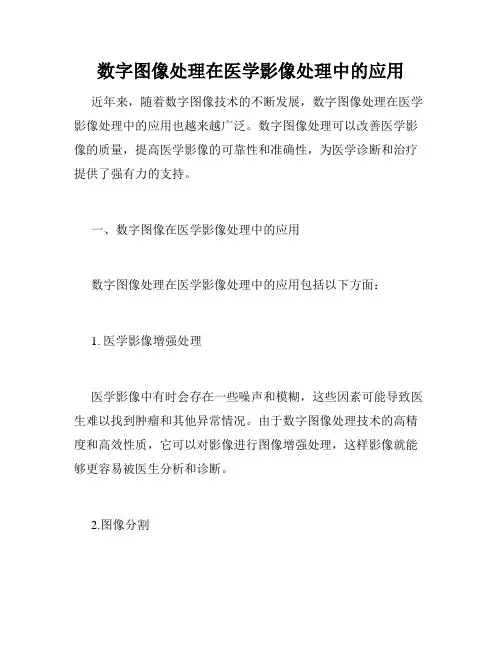 数字图像处理在医学影像处理中的应用