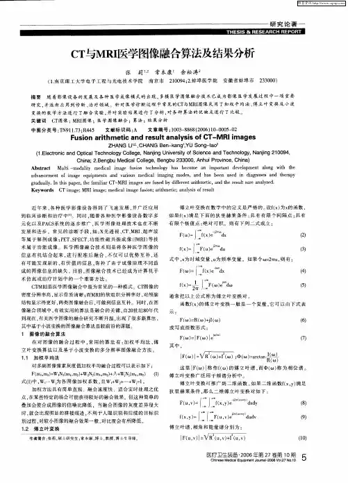 CT与MRI医学图像融合算法及结果分析