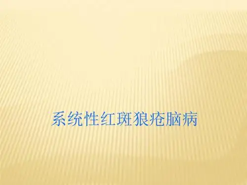 狼疮性脑病PPT医学课件