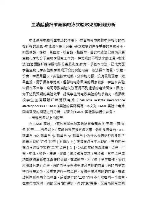 血清醋酸纤维薄膜电泳实验常见的问题分析
