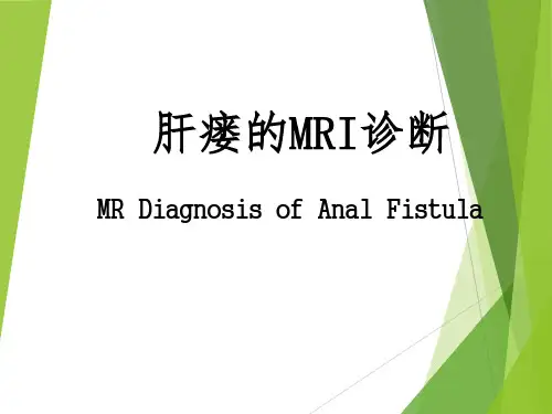肛瘘的MRI诊断及分型