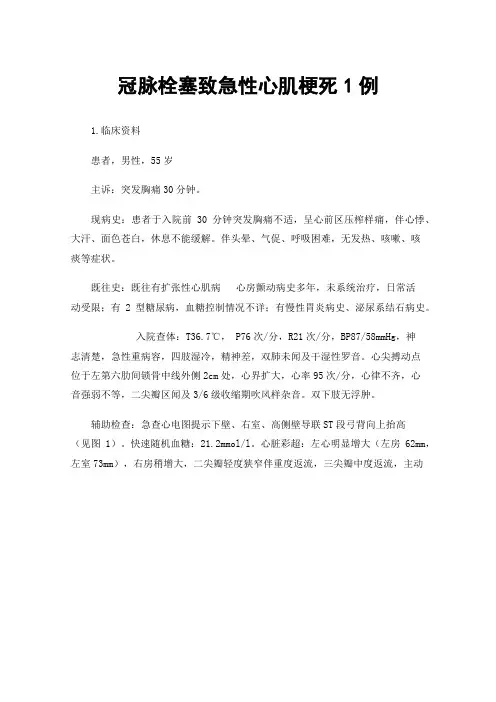 冠脉栓塞致急性心肌梗死1例