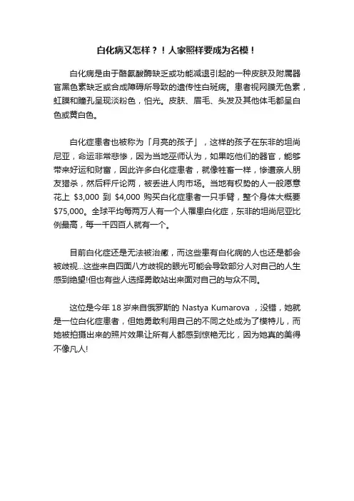 白化病又怎样？！人家照样要成为名模！