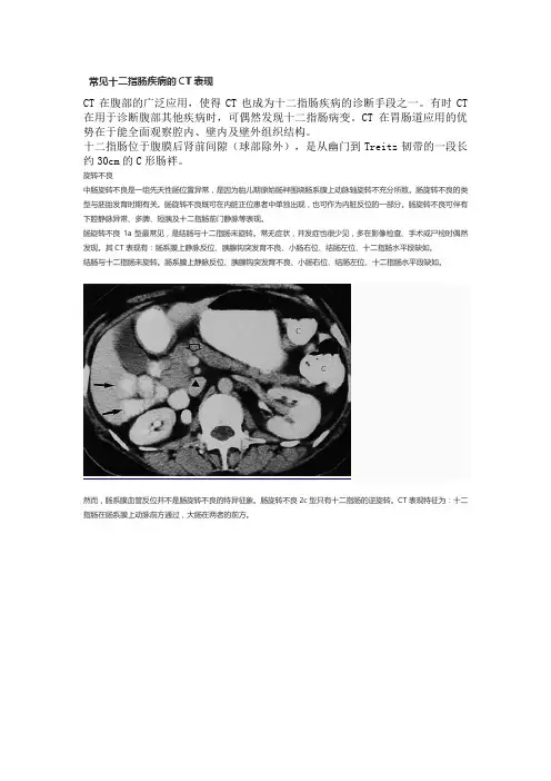 常见十二指肠疾病的CT表现