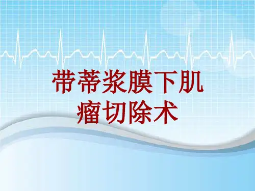 手术讲解模板：带蒂浆膜下肌瘤切除术