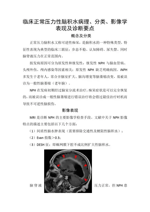临床正常压力性脑积水病理、分类、影像学表现及诊断要点