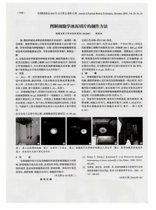 图解细胞学冰冻切片的制作方法