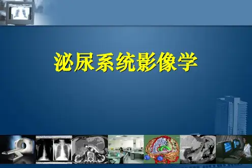 精品推荐医学影像诊断完整图文详解完整版-泌尿系统影像学ppt课件
