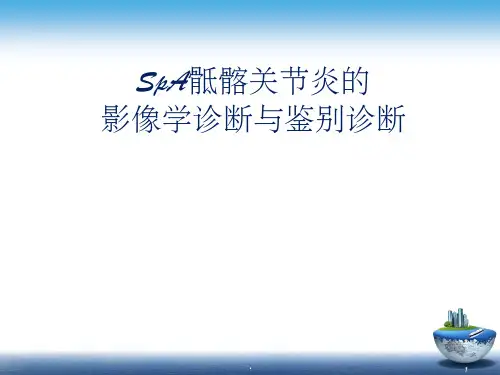 SpA骶髂关节炎的影像学诊断与鉴别诊断