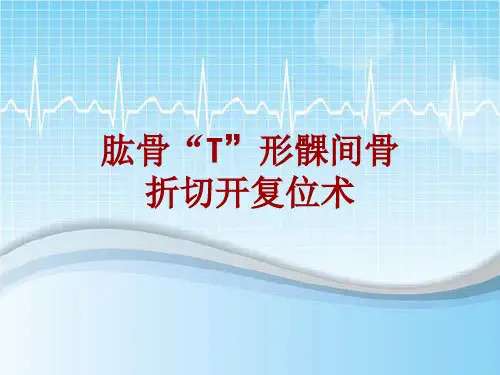 手术讲解模板：肱骨“T”形髁间骨折切开复位术
