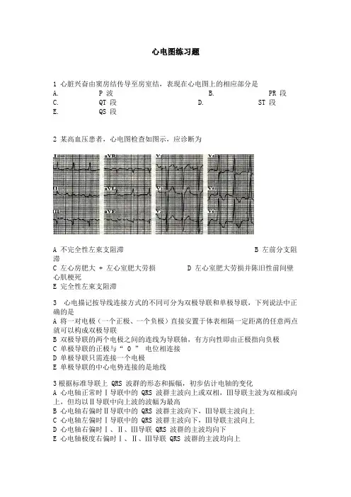 心电图练习题培训