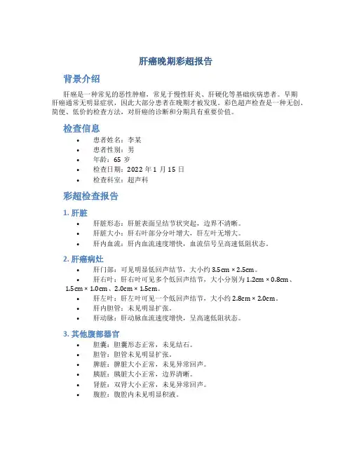 肝癌晚期彩超报告