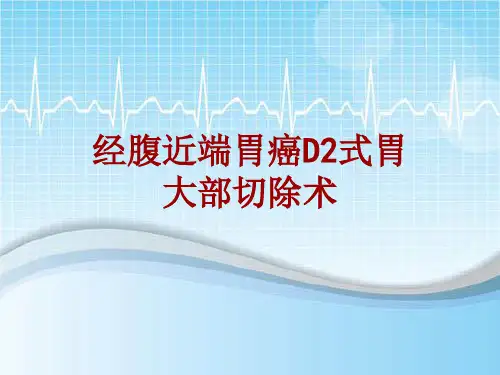 手术讲解模板：经腹近端胃癌D2式胃大部切除术