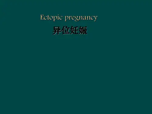 异位妊娠病人的护理ppt课件