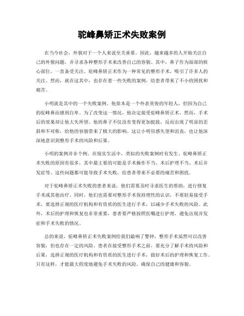 驼峰鼻矫正术失败案例