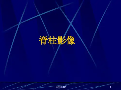 脊柱影像解剖ppt课件