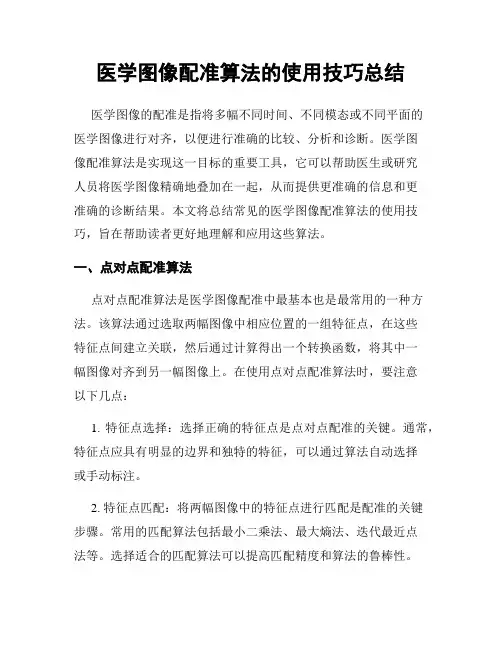医学图像配准算法的使用技巧总结