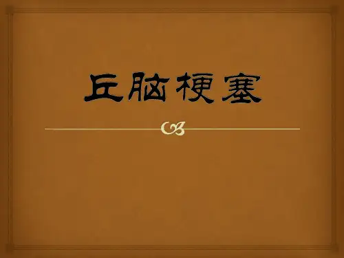 丘脑梗塞PPT课件