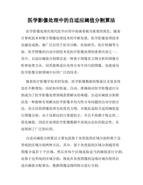 医学影像处理中的自适应阈值分割算法