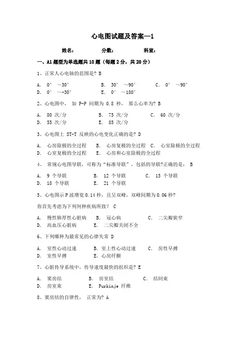 心电图试题及答案-1