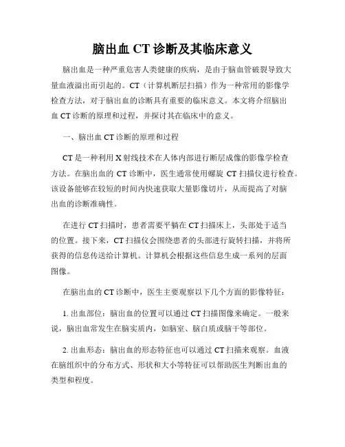 脑出血CT诊断及其临床意义