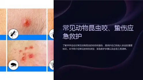 常见动物昆虫咬、蛰伤应急救护