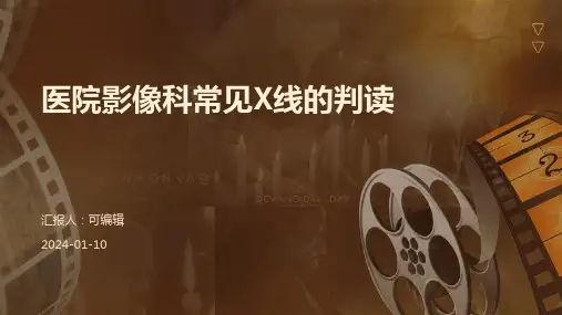 医院影像科常见X线的判读
