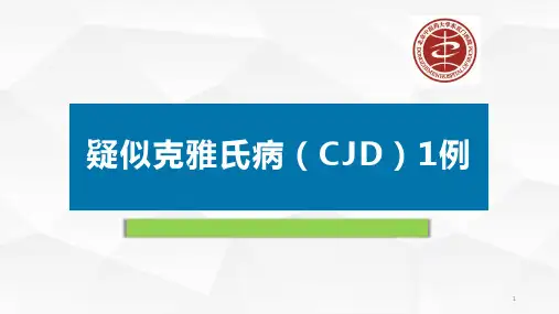 疑似克雅氏病(CJD)1例PPT课件