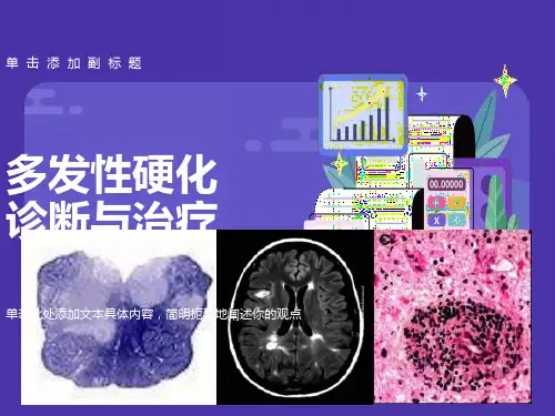 多发性硬化的诊断与治疗