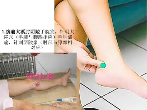 各种疼痛的针灸治疗穴位ppt课件