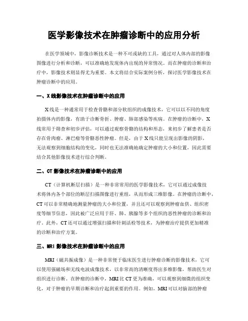 医学影像技术在肿瘤诊断中的应用分析
