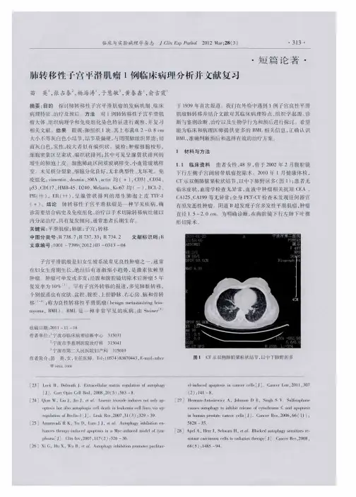 肺转移性子宫平滑肌瘤1例临床病理分析并文献复习