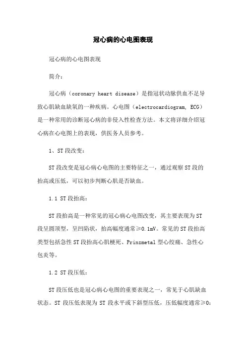 冠心病的心电图表现