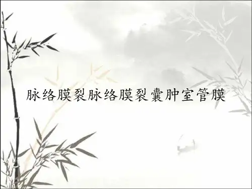脉络膜裂脉络膜裂囊肿室管膜