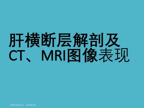 肝横断层解剖及CT、MRI图像表现