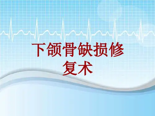 手术讲解模板：下颌骨缺损修复术