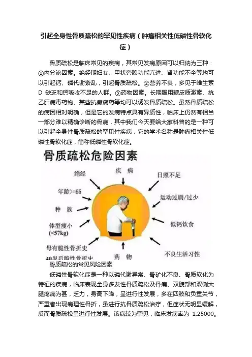 引起全身性骨质疏松的罕见性疾病（肿瘤相关性低磷性骨软化症）