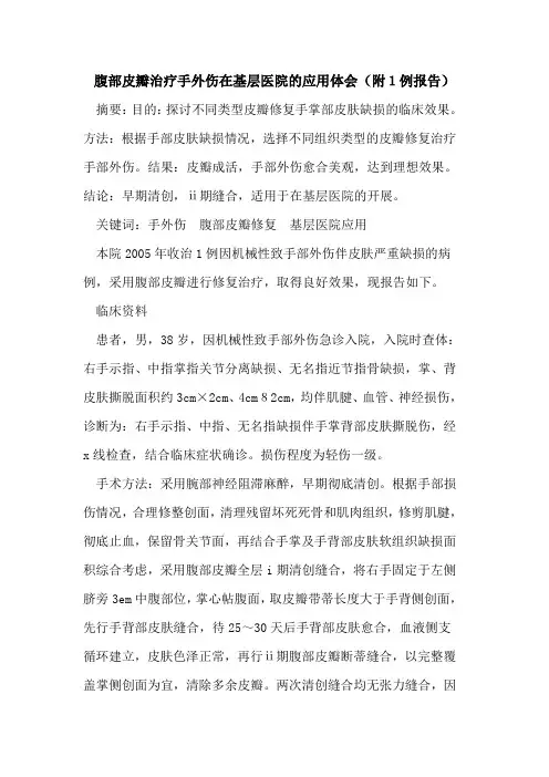 腹部皮瓣治疗手外伤在基层医院的应用体会(附1例报告)