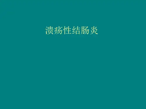 溃疡性结肠炎