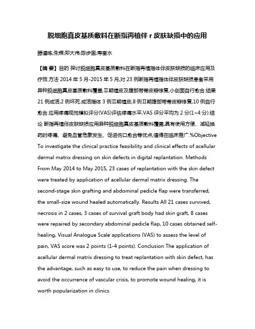 脱细胞真皮基质敷料在断指再植伴r皮肤缺损中的应用
