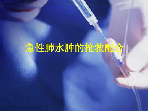护理查房-急性肺水肿抢救配合 PPT课件
