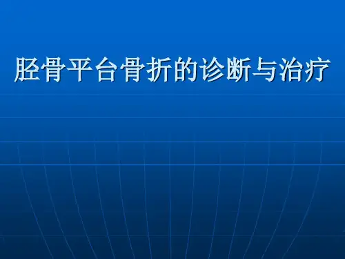 胫骨平台骨折