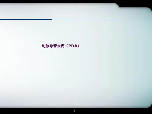 PDA(动脉导管未闭)ppt课件