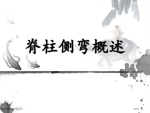 脊柱侧弯概述专题宣讲