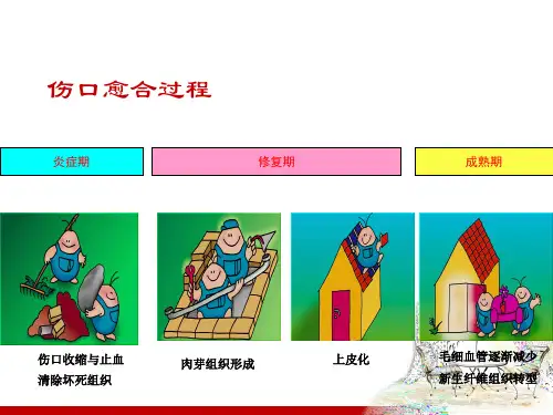 最新：新型伤口敷料的特性与应用ppt课件-文档资料